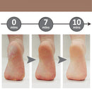 Soft Feet - Removedor de Calos Rachaduras